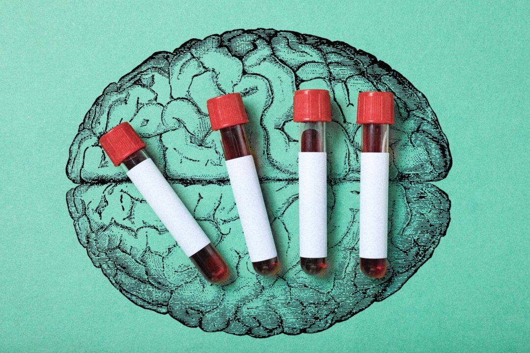 A Blood Test May Detect Alzheimer’s Years Before Symptoms Appear—Here’s What to Know